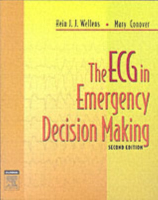 The ECG in Emergency Decision Making