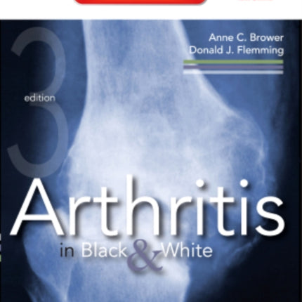 Arthritis in Black and White: Expert Consult - Online and Print