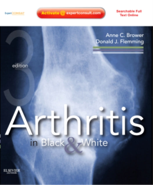 Arthritis in Black and White: Expert Consult - Online and Print