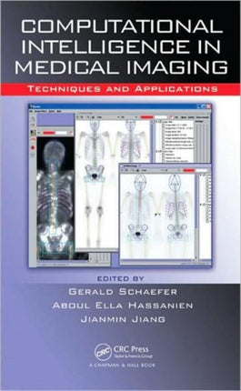 Computational Intelligence in Medical Imaging: Techniques and Applications