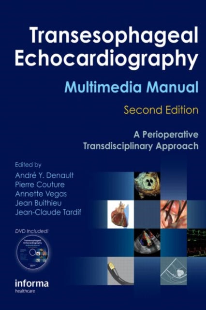 Transesophageal Echocardiography Multimedia