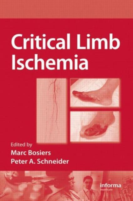 Critical Limb Ischemia