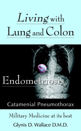 Living With Lung and Colon Endometriosis Catamenial Pneumothorax