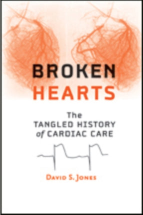 Broken Hearts: The Tangled History of Cardiac Care