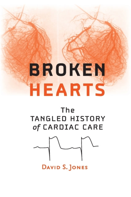 Broken Hearts: The Tangled History of Cardiac Care