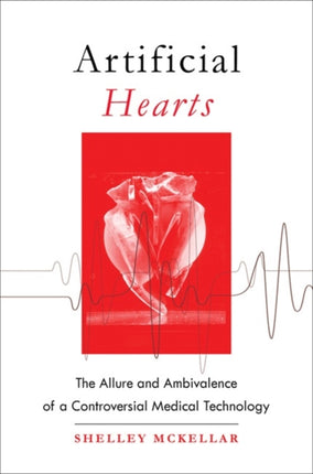 Artificial Hearts: The Allure and Ambivalence of a Controversial Medical Technology