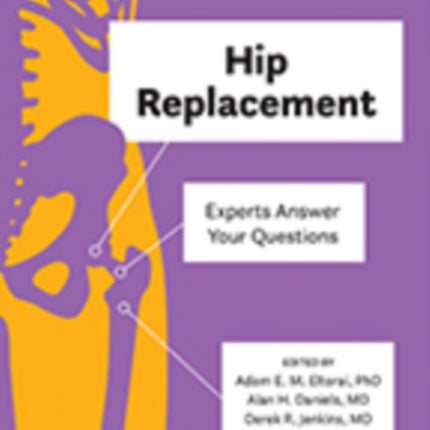 Hip Replacement: Experts Answer Your Questions