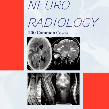 Atlas Of NEURORADIOLOGY