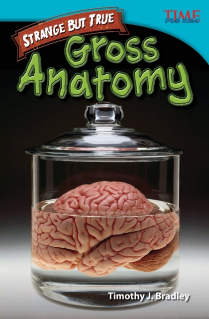 Strange but True: Gross Anatomy