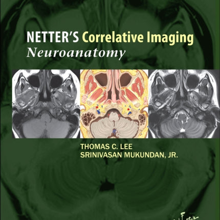 Netter's Correlative Imaging: Neuroanatomy: with NetterReference.com Access