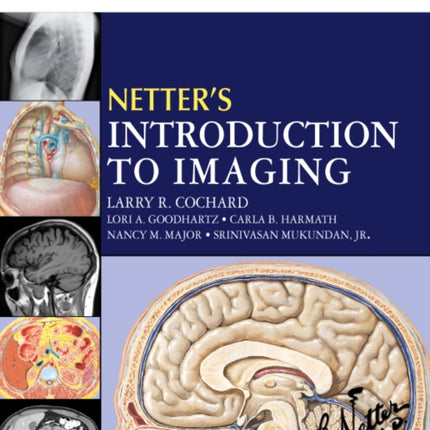 Netter's Introduction to Imaging: with Student Consult Access