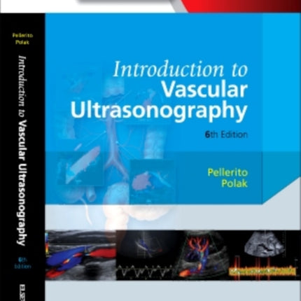 Introduction to Vascular Ultrasonography EBook Expert Consult  Online and Print Zwiebel Introduction of Vascular Ultrasonography