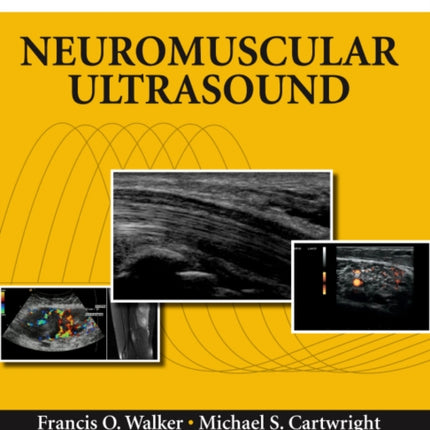 Neuromuscular Ultrasound: Expert Consult - Online and Print