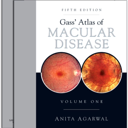 Gass' Atlas of Macular Diseases: 2-Volume Set - Expert Consult: Online and Print