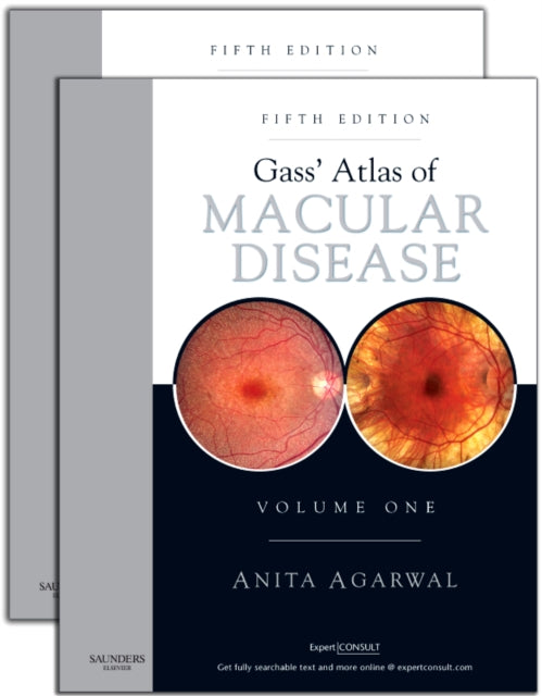 Gass' Atlas of Macular Diseases: 2-Volume Set - Expert Consult: Online and Print