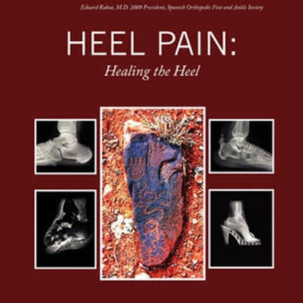 Heel Pain