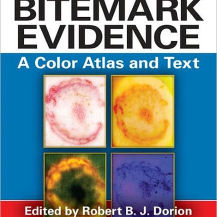 Bitemark Evidence
