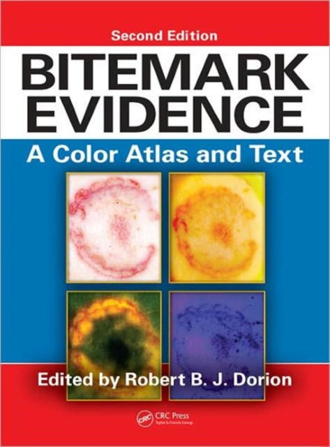 Bitemark Evidence