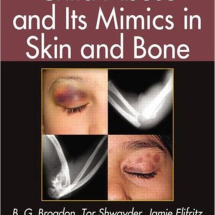 Child Abuse and its Mimics in Skin and Bone