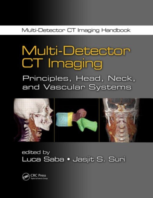 Multi-Detector CT Imaging: Principles, Head, Neck, and Vascular Systems