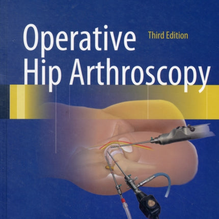 Operative Hip Arthroscopy