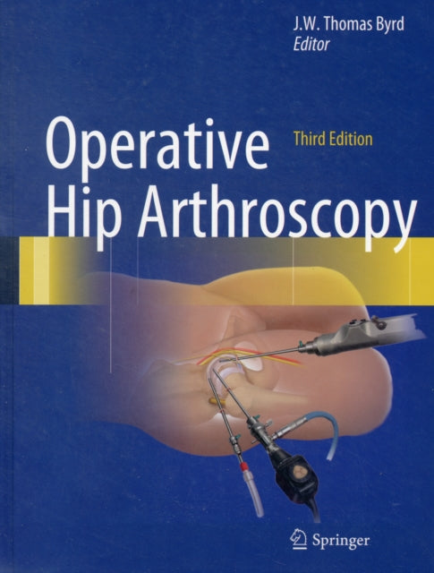 Operative Hip Arthroscopy