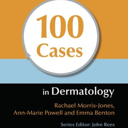 100 Cases in Dermatology