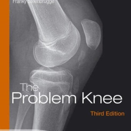 The Problem Knee