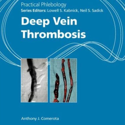 Practical Phlebology: Deep Vein Thrombosis