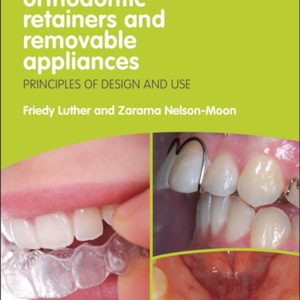 Orthodontic Retainers and Removable Appliances