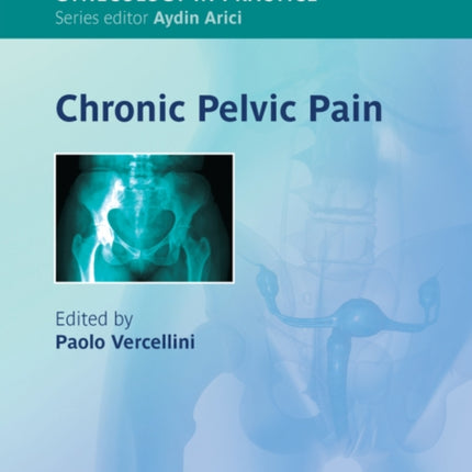 Chronic Pelvic Pain
