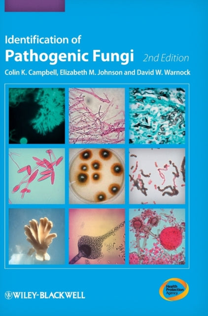 Identification of Pathogenic Fungi