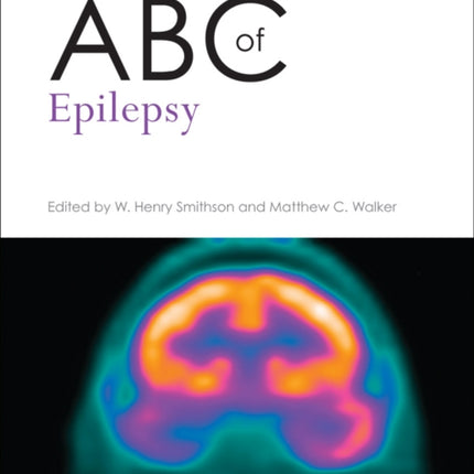 ABC of Epilepsy