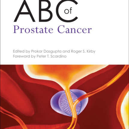 ABC of Prostate Cancer