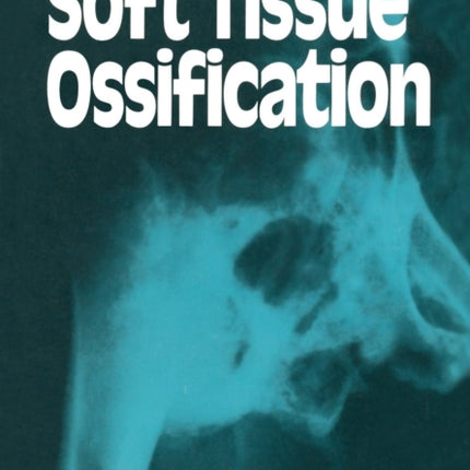 Soft Tissue Ossification
