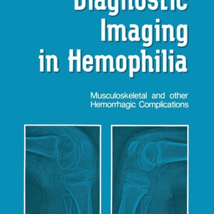 Diagnostic Imaging in Hemophilia Musculoskeletal And Other Hemorrhagic Complications