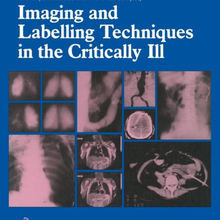 Imaging and Labelling Techniques in the Critically Ill Current Concepts in Critical Care