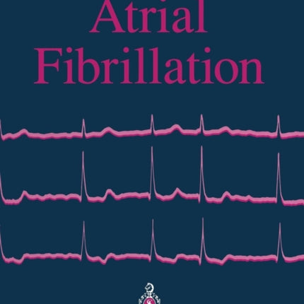 Atrial Fibrillation