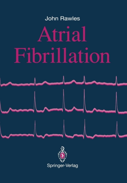 Atrial Fibrillation
