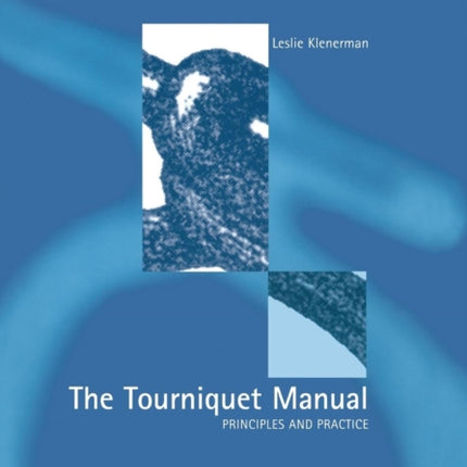 The Tourniquet Manual  Principles and Practice