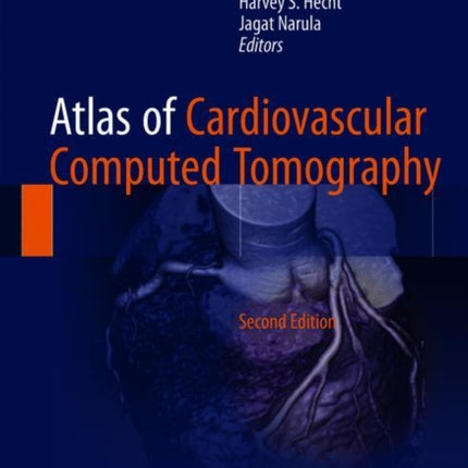 Atlas of Cardiovascular Computed Tomography