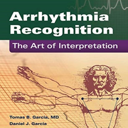 Arrhythmia Recognition: The Art Of Interpretation