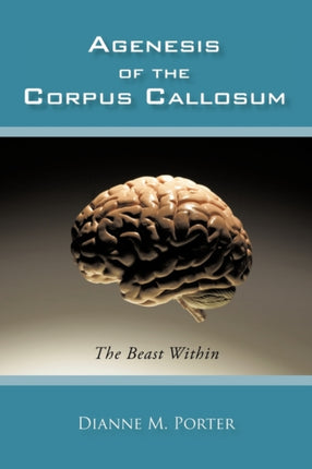 Agenesis of the Corpus Callosum The Beast Within