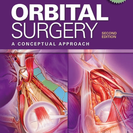 Orbital Surgery: A Conceptual Approach