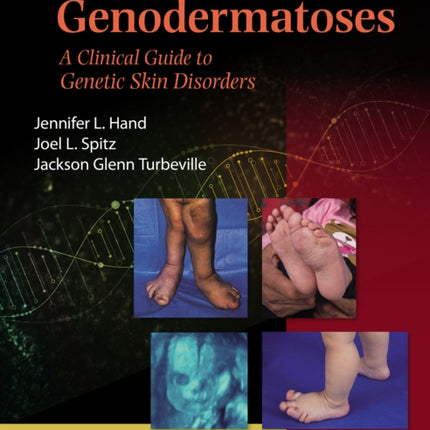 Spitz39s Genodermatoses