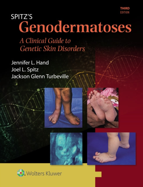 Spitz39s Genodermatoses