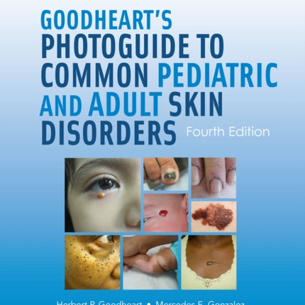 Goodheart's Photoguide to Common Pediatric and Adult Skin Disorders