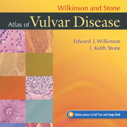 Wilkinson and Stone Atlas of Vulvar Disease