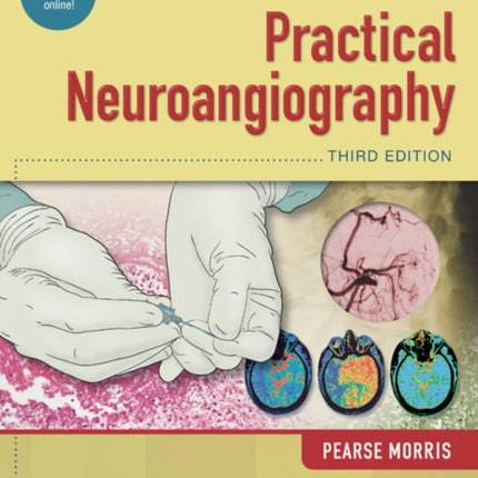 Practical Neuroangiography