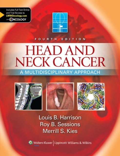 Head and Neck Cancer: A Multidisciplinary Approach